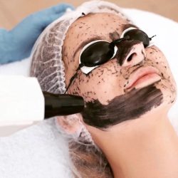 CARBON PEEL copy