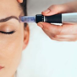 MICRONEEDLING copy
