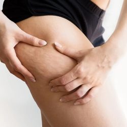 PACK Anti Cellulite copy